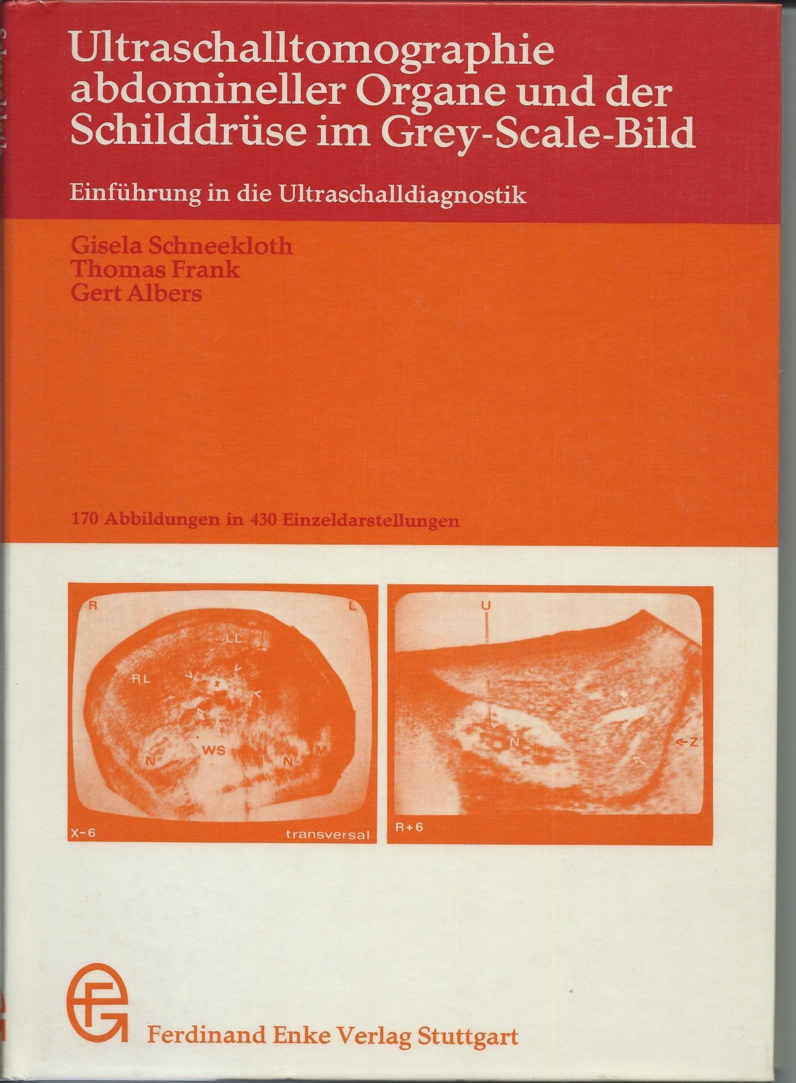 Ultraschalltomographie abdomineller Organe und der Schilddrüse. Atlas und Lehrbuch Books