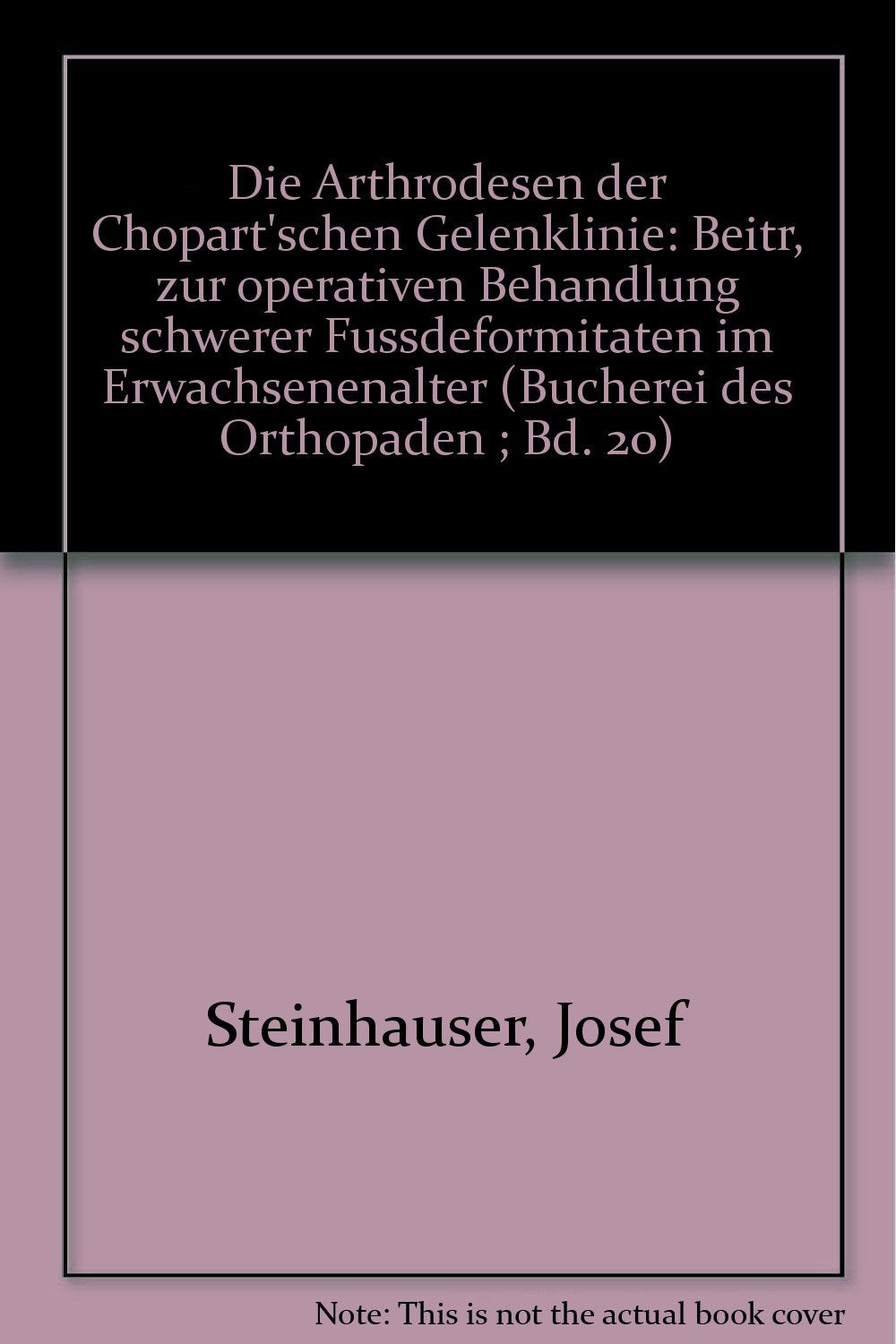 Die Arthrodesen der Chopart'schen Gelenklinie - Beitr. zur operativen Behandlung schwerer Fussdeformitäten im Erwachsenenalter. Books