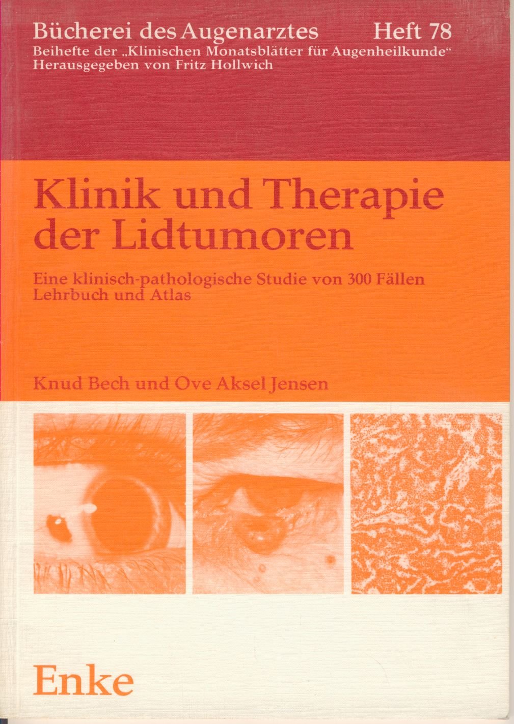 Klinik und Therapie der Lidtumoren Books