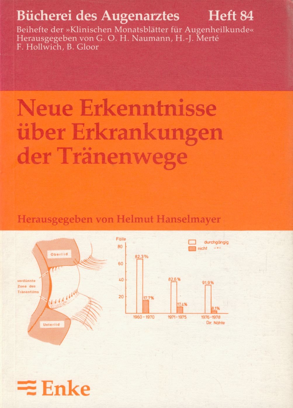 Neue Erkenntnisse über Erkrankungen der Tränenwege Books