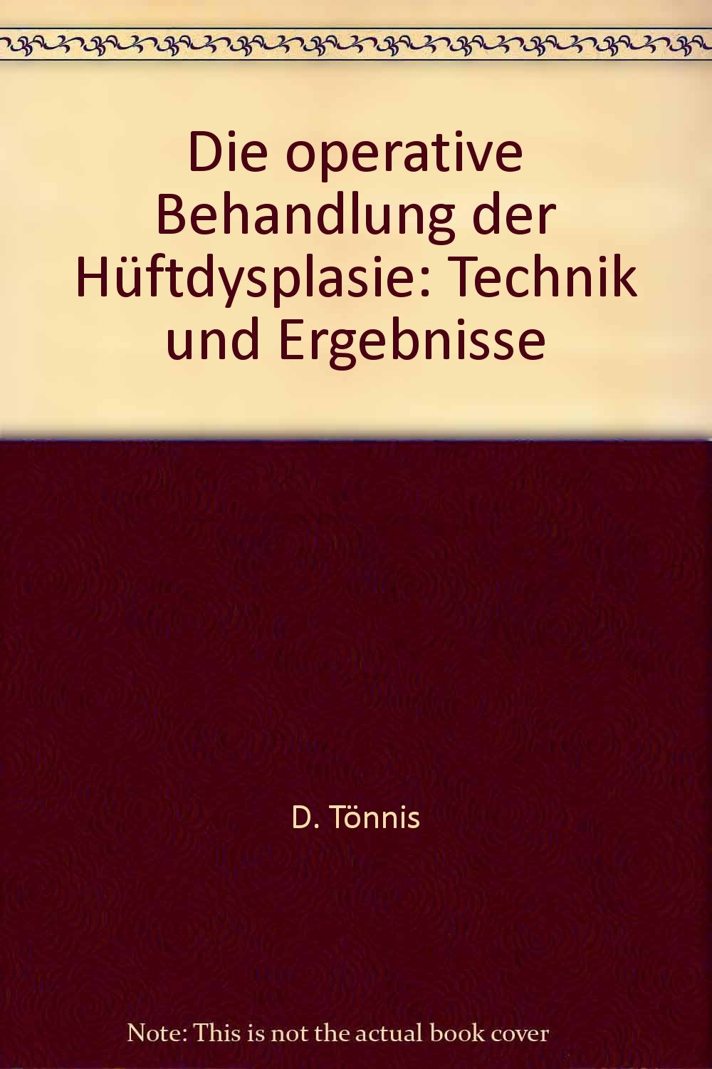 Die operative Behandlung der Hüftdysplasie. Technik und Ergebnisse Medicine