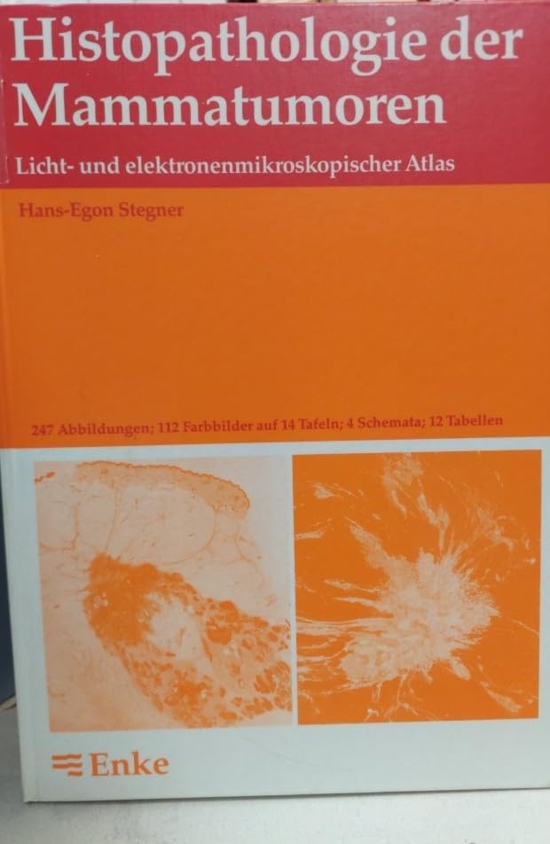 Histopathologie der Mammatumoren. Licht- und elektronenmikroskopischer Atlas Books