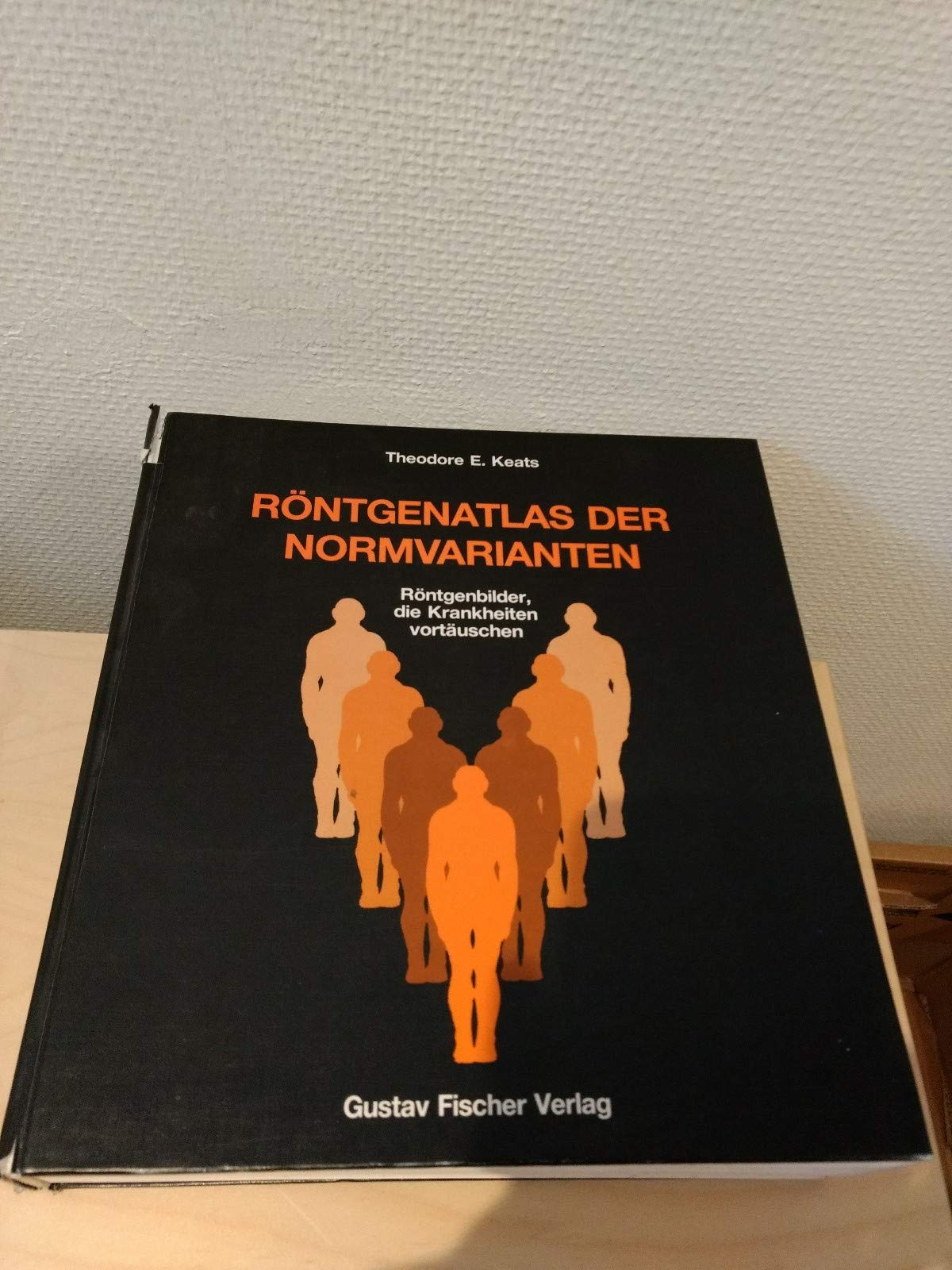 Röntgenatlas der Normvarianten. Röntgenbilder, die Krankheiten vortäuschen Medicine