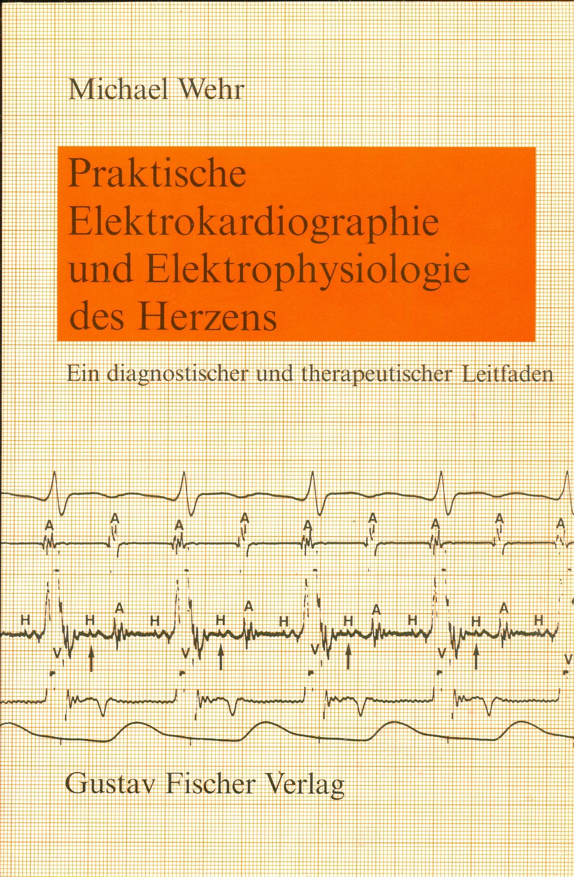Praktische Elektrokardiographie und Elektrophysiologie des Herzens Medicine