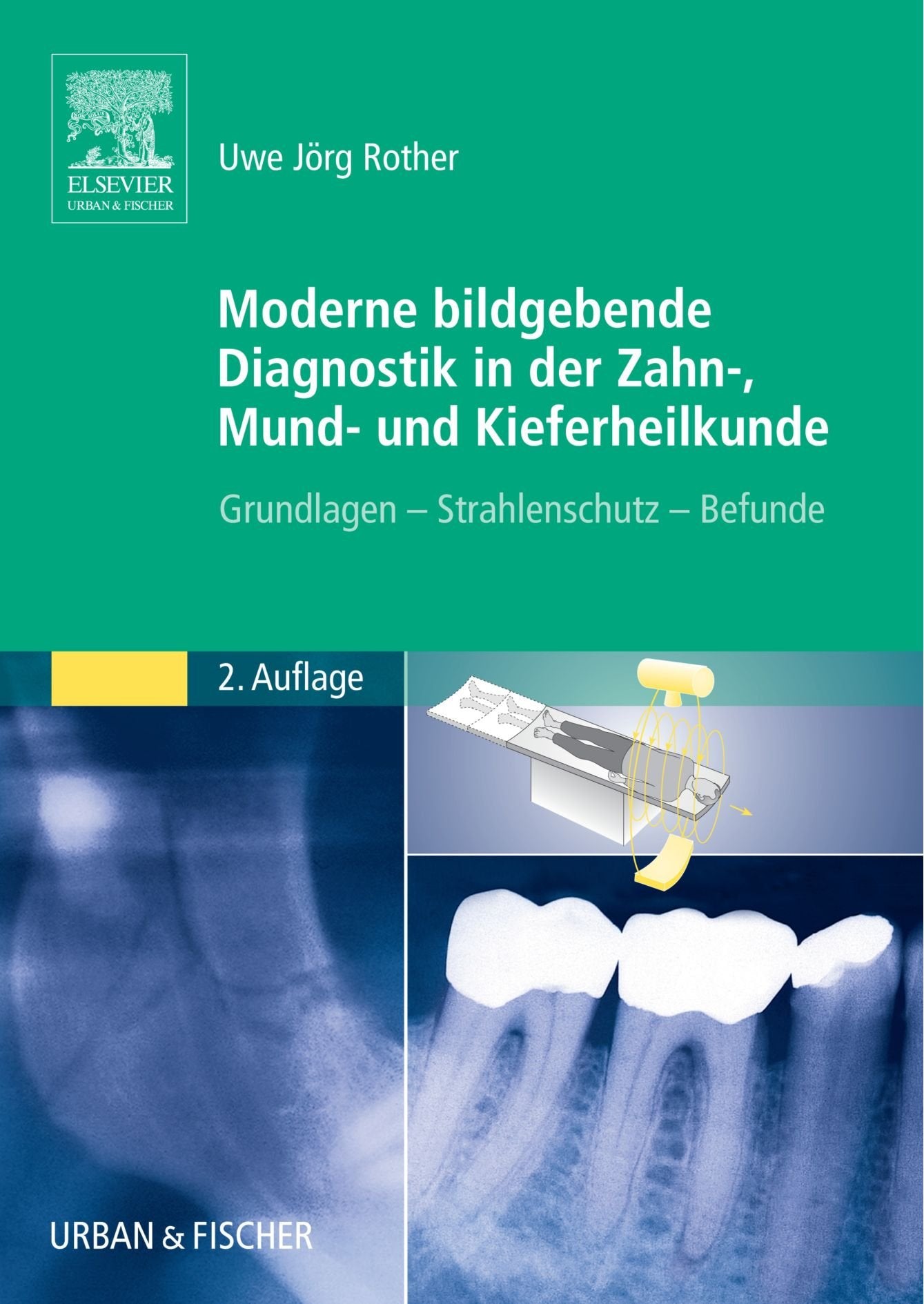 Moderne Bildgebende Diagnostik in der Zahn-, Mund- und Kieferheilkunde: Grundlagen - Strahlenschutz - Befunde Medicine