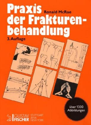 Praxis der Frakturenbehandlung Books