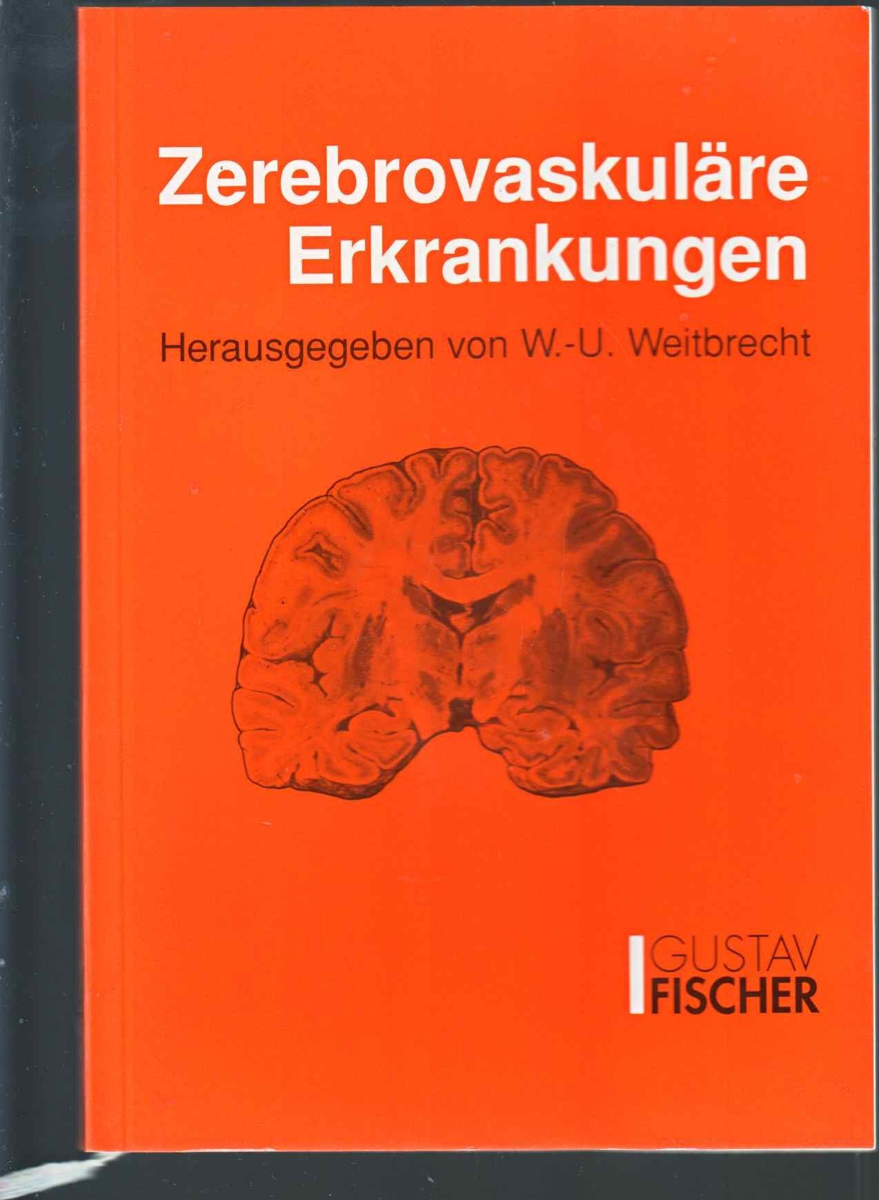 Zerebrovaskuläre Erkrankungen Medicine