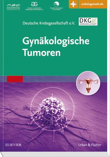 Gynäkologische Tumoren: mit Zugang zur Medizinwelt Medicine