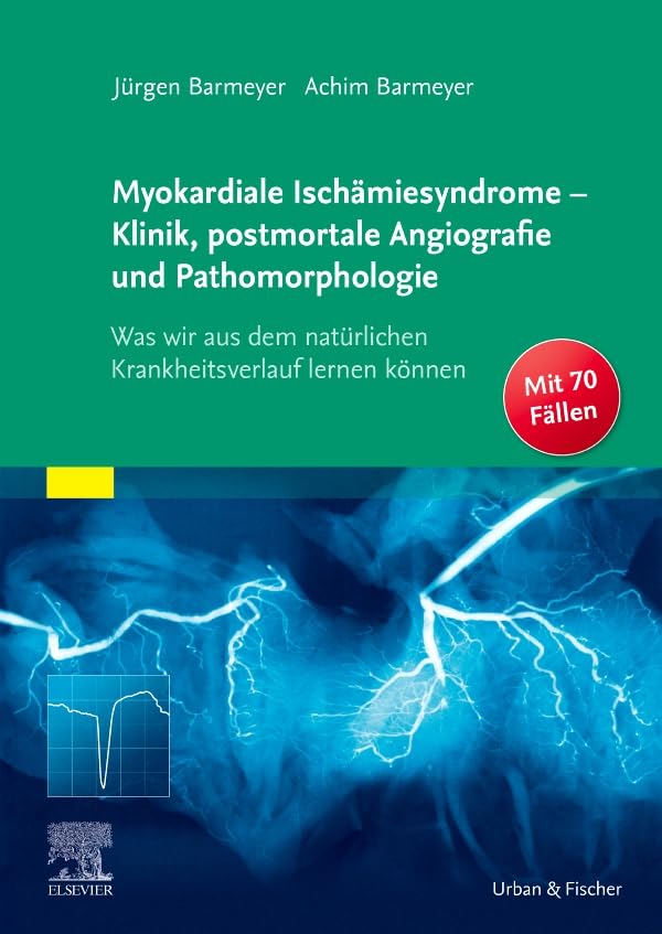 Myokardiale Ischämiesyndrome - Klinik, postmortale Angiografie und Pathomorphologie Medicine