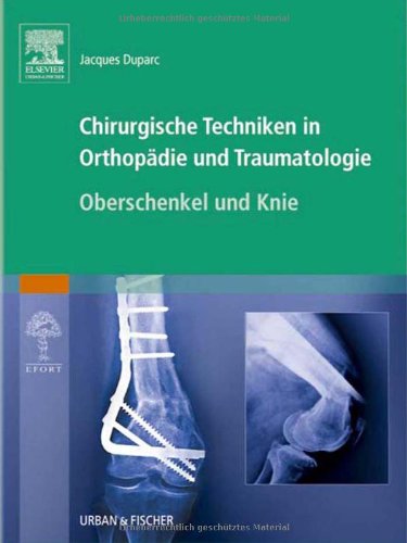 Chirurgische Techniken in Orthopädie und Traumatologie 8 Bände: Chirurgische Techniken in Orthopädie und Traumatologie: Oberschenkel und Knie Medicine