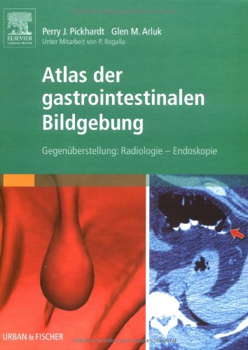 Atlas der gastrointestinalen Bildgebung: Gegenüberstellung: Radiologie – Endoskopie Medicine