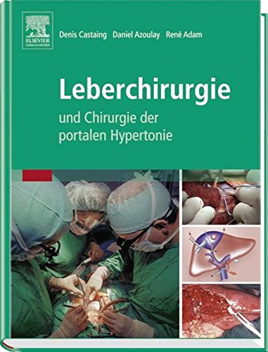 Leberchirurgie: und Chirurgie der portalen Hypertonie Medicine