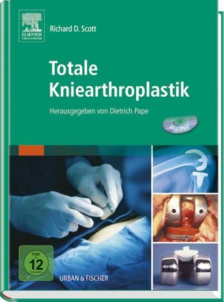 Totale Kniearthroplastik: Herausgegeben von Dietrich Pape Medicine