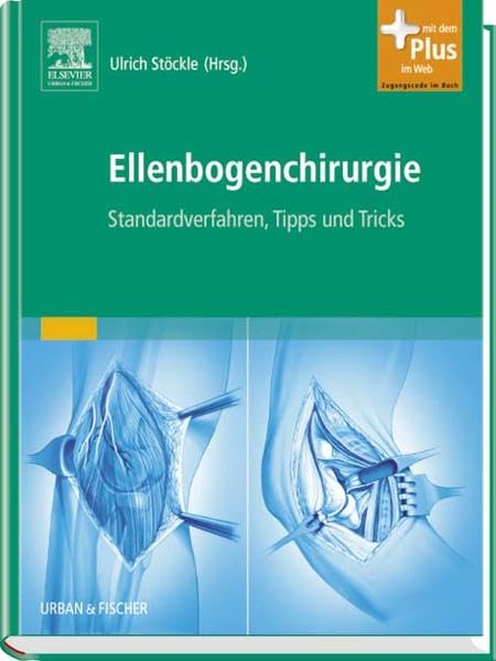 Ellenbogenchirurgie: Atlas zu Standardverfahren, Tipps und Tricks - mit Zugang zum Elsevier-Portal: Atlas zu Standardverfahren, Tipps und Tricks. Mit dem Plus im Web. Zugangscode im Buch Medicine