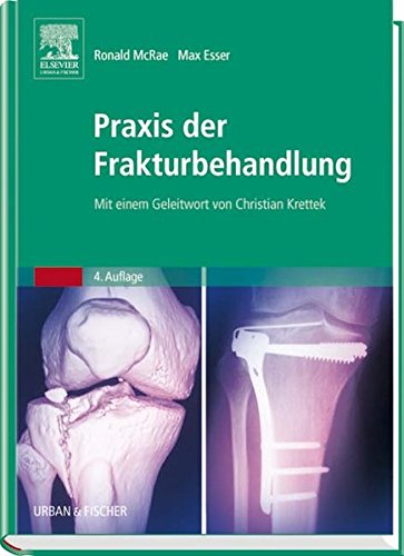 Praxis der Frakturbehandlung: Mit einem Geleitwort von Christian Krettek Medicine