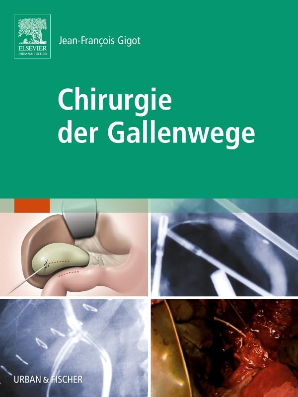 Chirurgie der Gallenwege Medicine