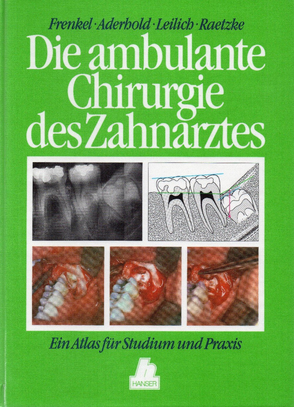 Product Image: Ambulante Chirurgie