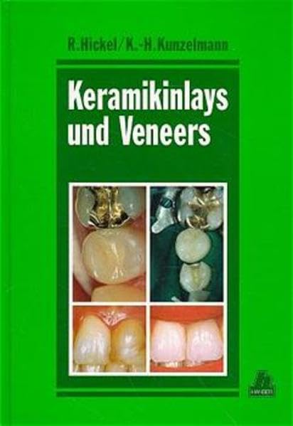 Keramikinlays und Veneers Medicine