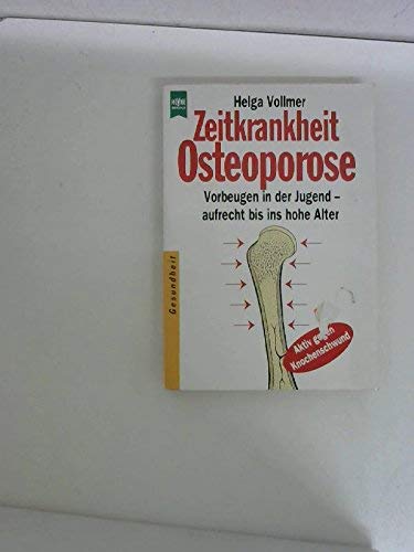 Zeitkrankheit Osteoporose Health, Nutrition & Fitness