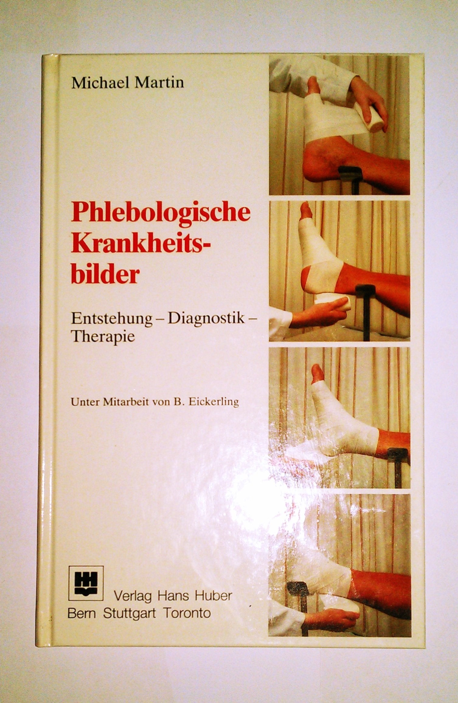 Phlebologische Krankheitsbilder: Entstehung - Diagnostik - Therapie Medicine