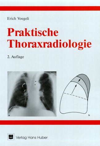 Praktische Thoraxradiologie Medicine