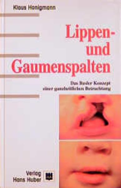 Lippen- und Gaumenspalten: Das Basler Konzept einer ganzheitlichen Betrachtung Medicine