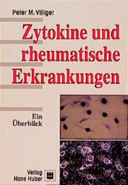 Zytokine und rheumatische Erkrankungen: Ein Überblick Medicine