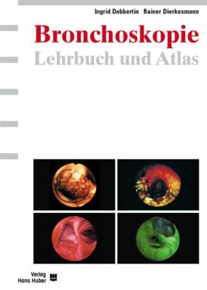 Lehrbuch und Atlas der Bronchoskopie: Geschichte, Techniken, Krankheitsbilder Medicine