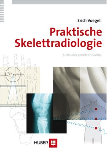 Praktische Skelettradiologie Medicine
