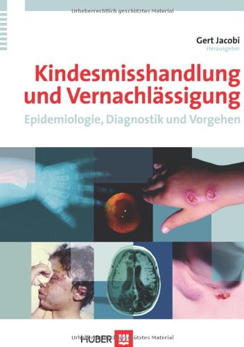 Kindesmisshandlung und Vernachlässigung: Epidemiologie, Diagnostik und Vorgehen Medicine