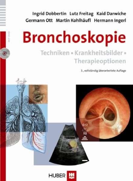 Bronchoskopie: Techniken • Krankheitsbilder • Therapieoptionen Medicine