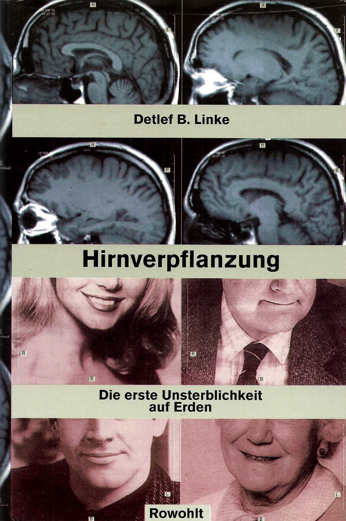Hirnverpflanzung. Die erste Unsterblichkeit auf Erden Medicine