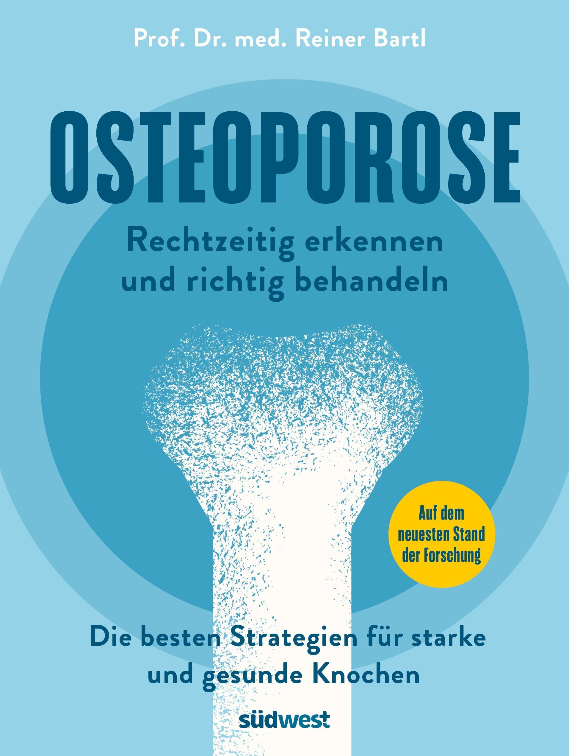 Osteoporose rechtzeitig erkennen und behandeln Medicine