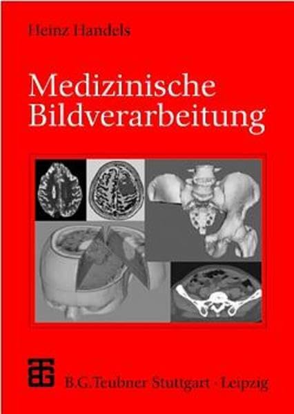 Medizinische Bildverarbeitung (XLeitfäden der Informatik) Medicine