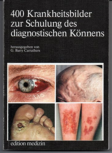 Vierhundert Krankheitsbilder zur Schulung des diagnostischen Könnens Medicine