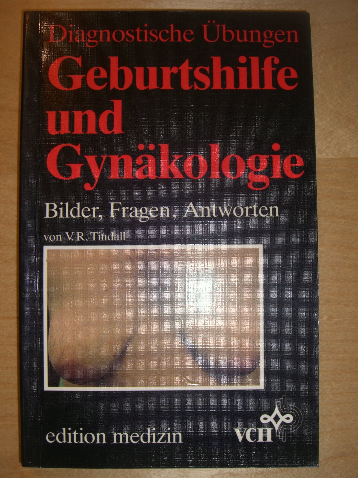 Geburtshilfe und Gynäkologie. Bilder, Fragen, Antworten Medicine