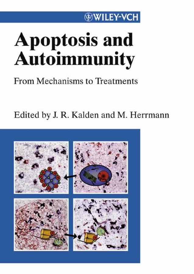 Apoptosis and Autoimmunity: From Mechanisms to Treatments Medicine