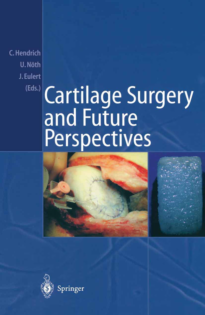 Cartilage Surgery and Future Perspectives Medicine