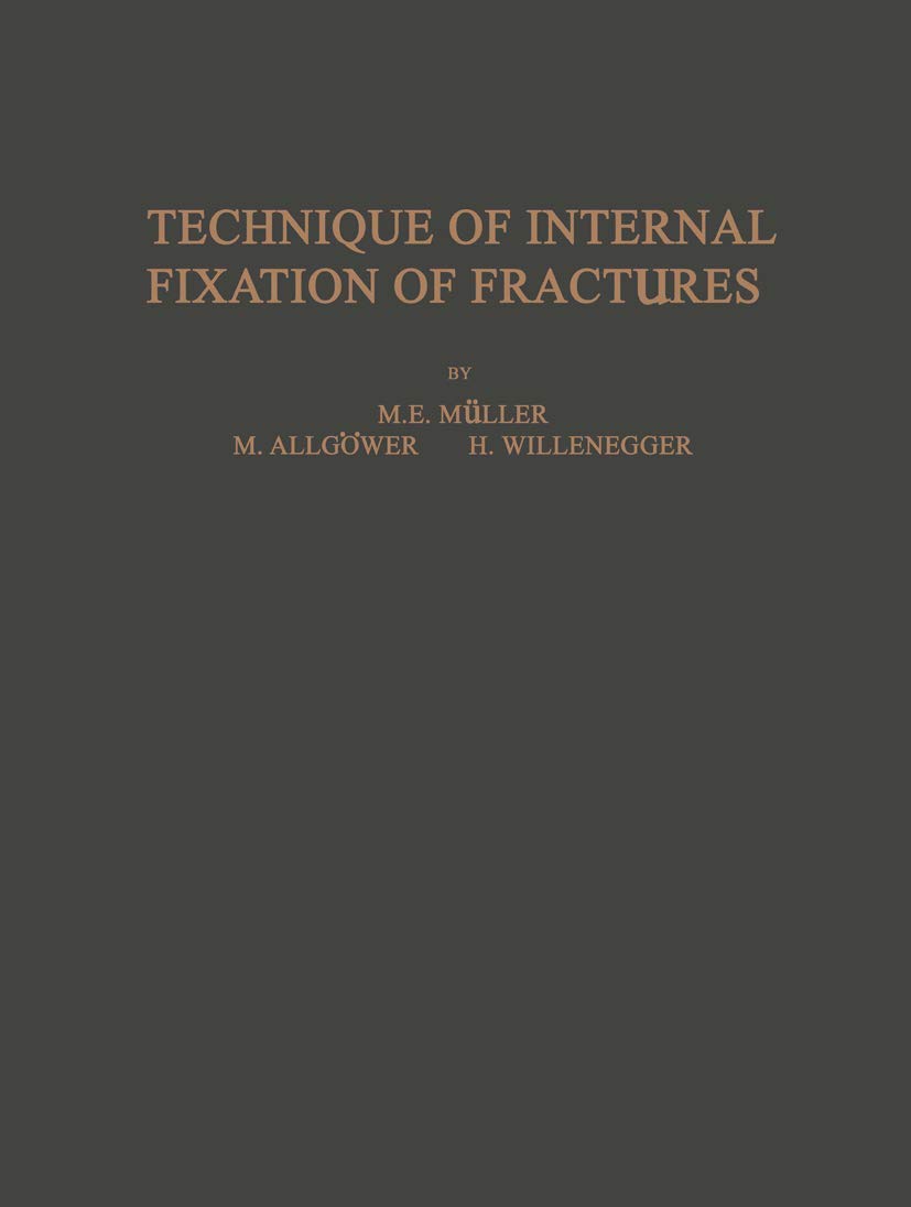 Technique of Internal Fixation of Fractures Medicine