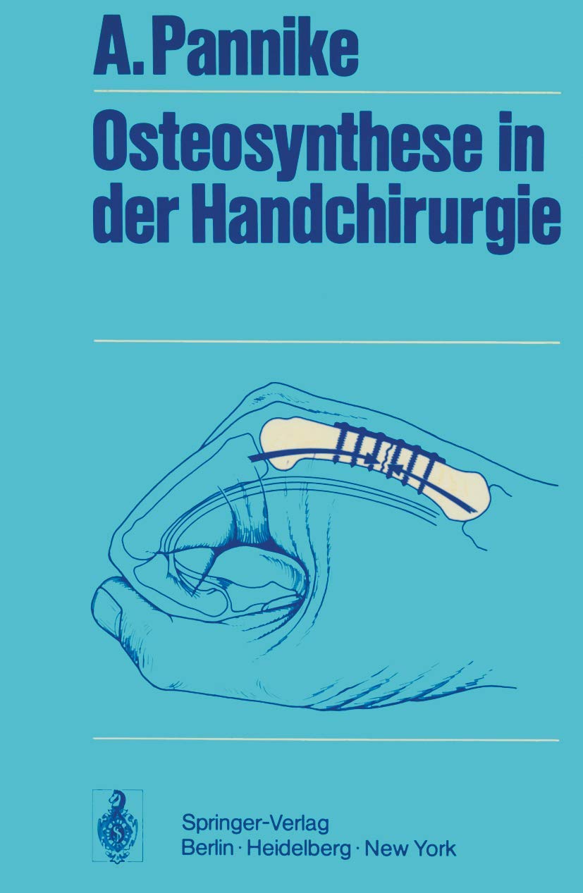 Osteosynthese in der Handchirurgie Medicine