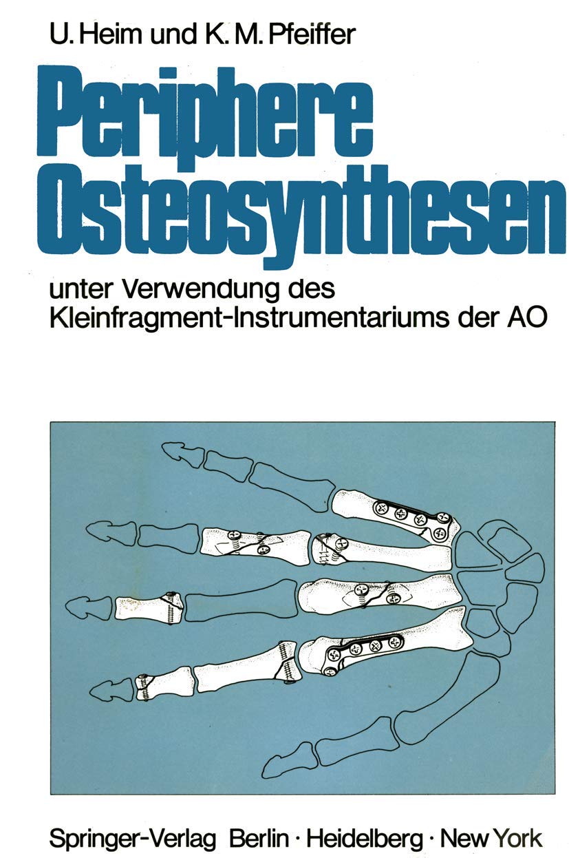 Periphere Osteosynthesen unter Verwendung des Kleinfragment-Instrumentariums der AO Medicine