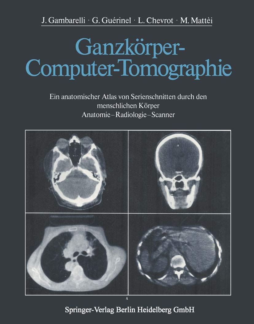 Ganzkörper-Computer-Tomographie: Ein anatomischer Atlas von Serienschnitten durch den menschlichen Körper Anatomie ― Radiologie ― Scanner Medicine