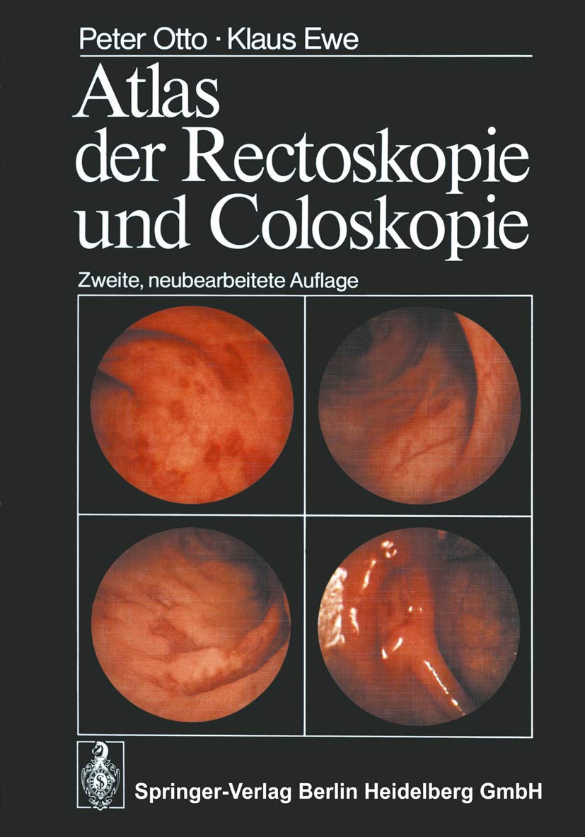 Atlas der Rectoskopie und Coloskopie Medicine