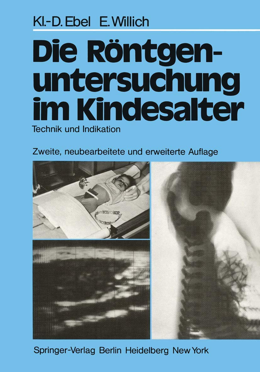 Die Röntgenuntersuchung im Kindesalter: Technik und Indikation Medicine