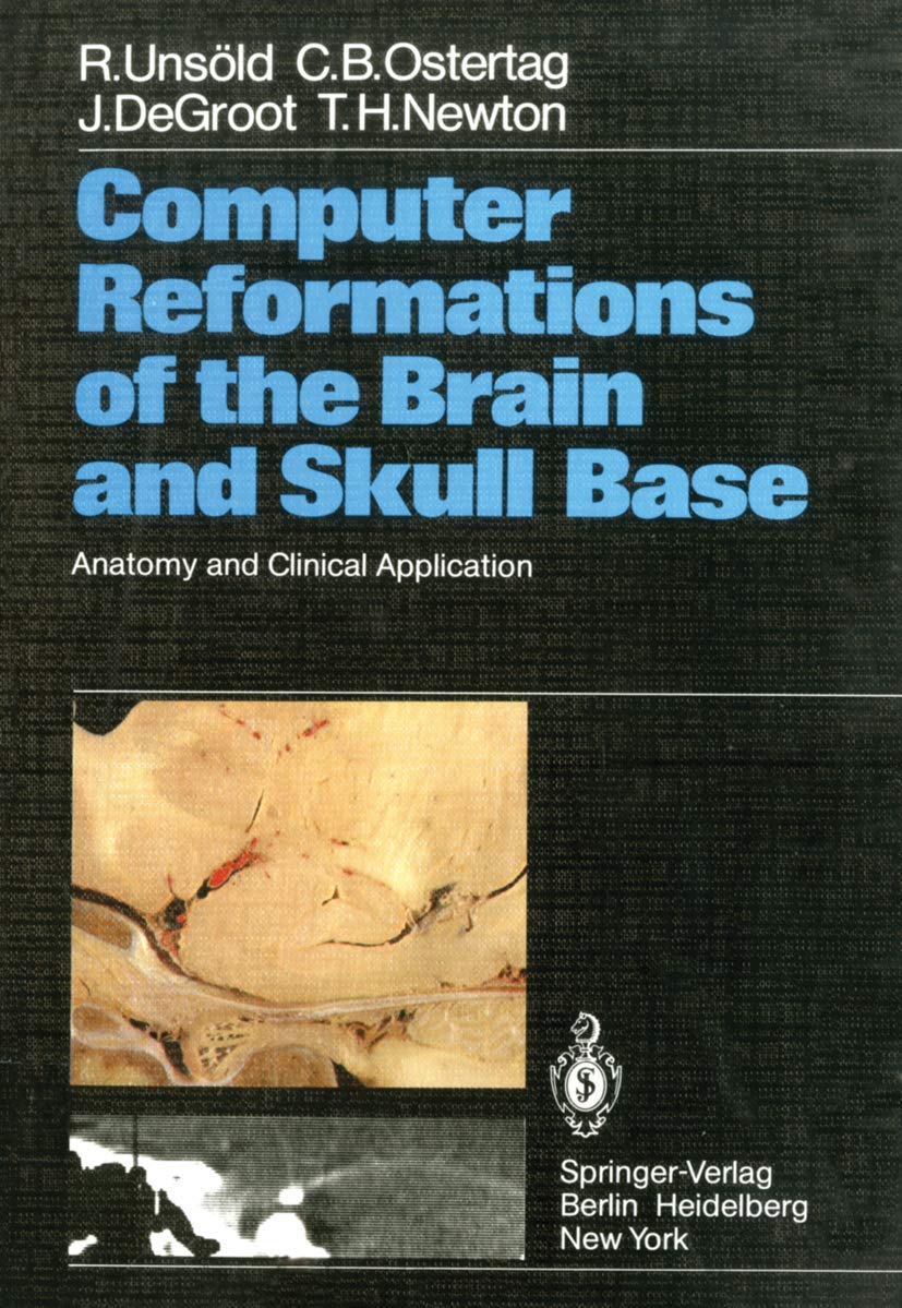 Computer Reformations of the Brain and Skull Base: Anatomy and Clinical Application Medicine