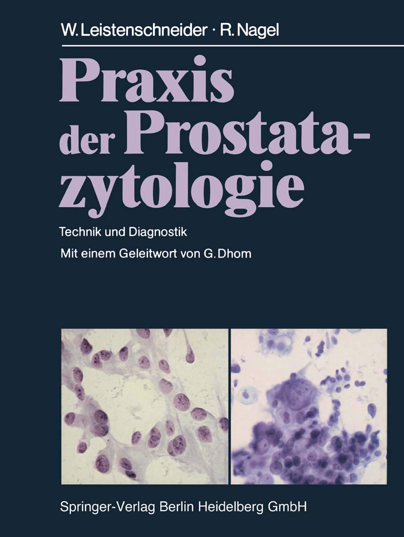 Praxis der Prostatazytologie: Technik und Diagnostik Medicine