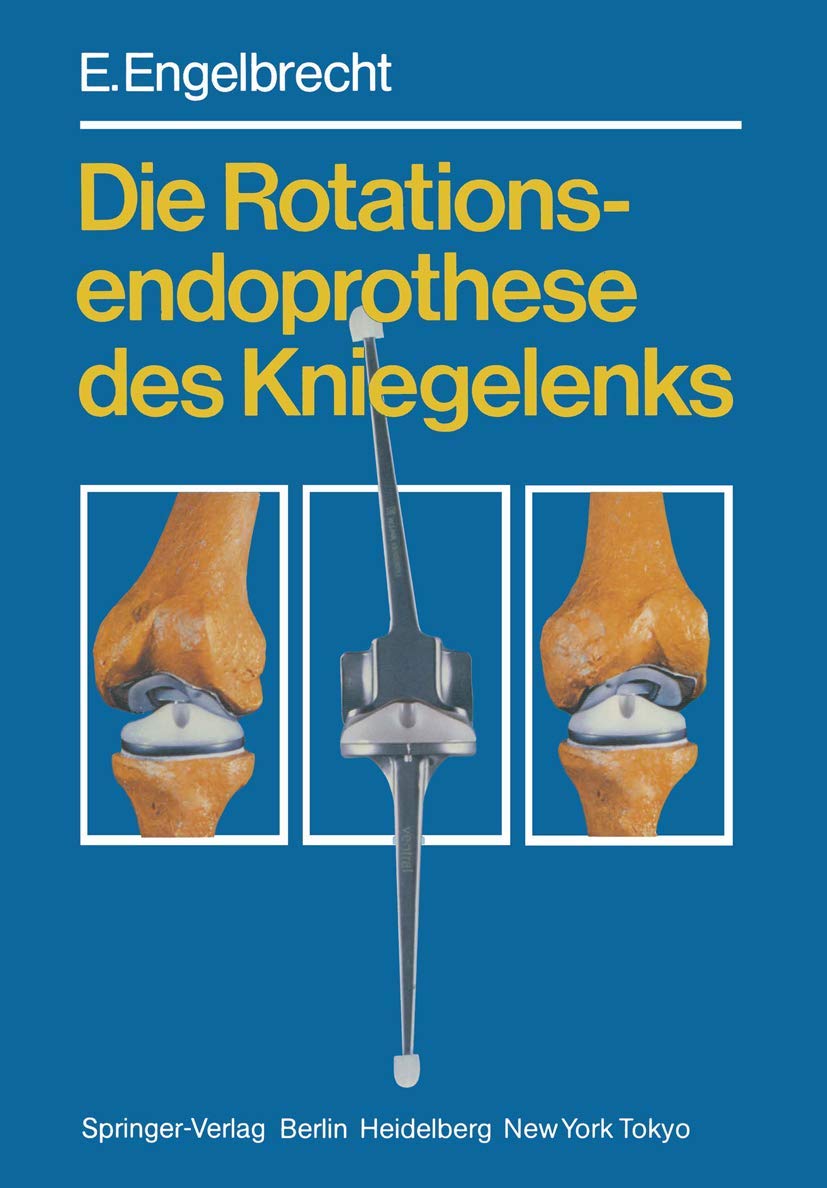 Die Rotationsendoprothese des Kniegelenks Medicine