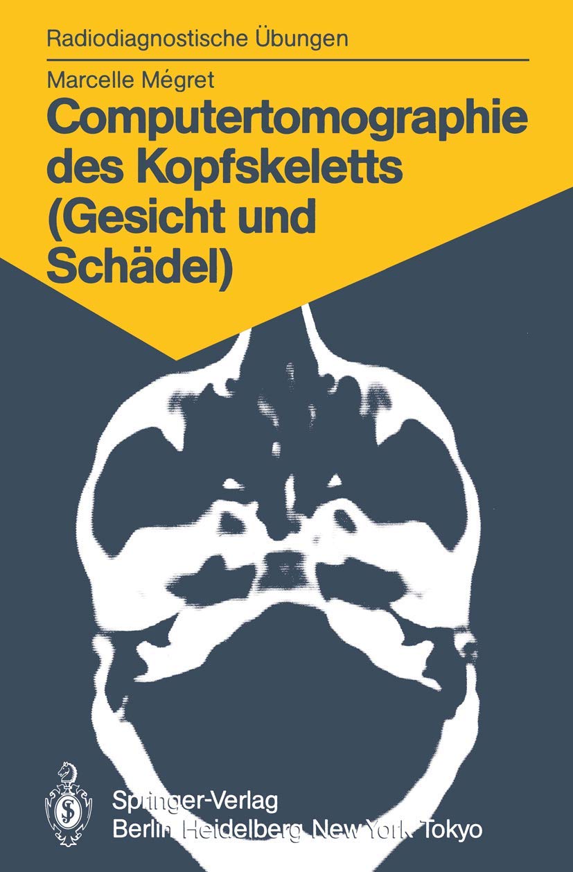 Computertomographie des Kopfskeletts (Gesicht und Schädel) Medicine