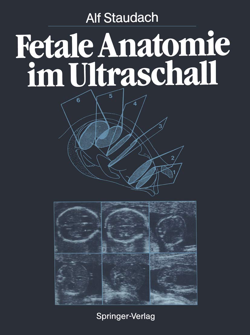 Fetale Anatomie im Ultraschall Medicine