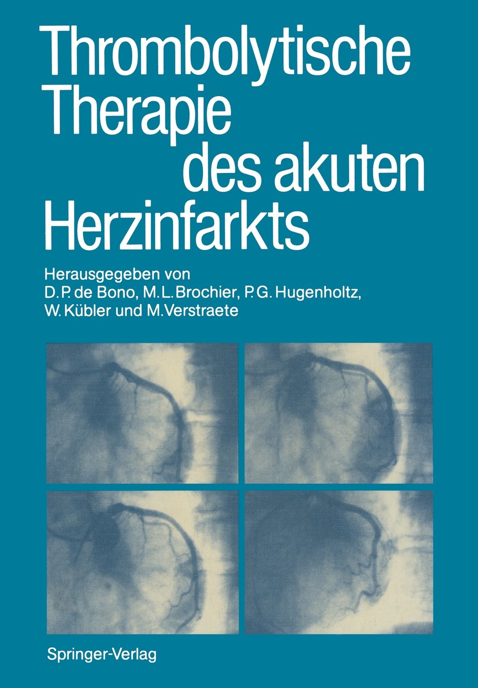 Thrombolytische Therapie des akuten Herzinfarkts (German Edition) Medicine